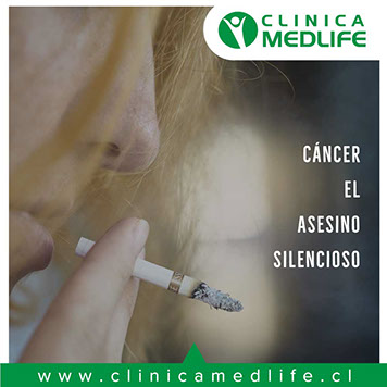 previene el cáncer de diversos tipos gracias a nuestro especialista en medicina general