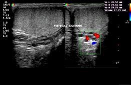 urologia testiculo