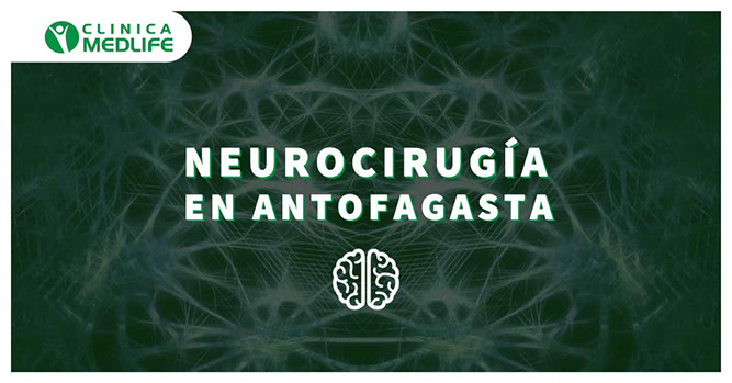 neurocirujano infantil antofagasta